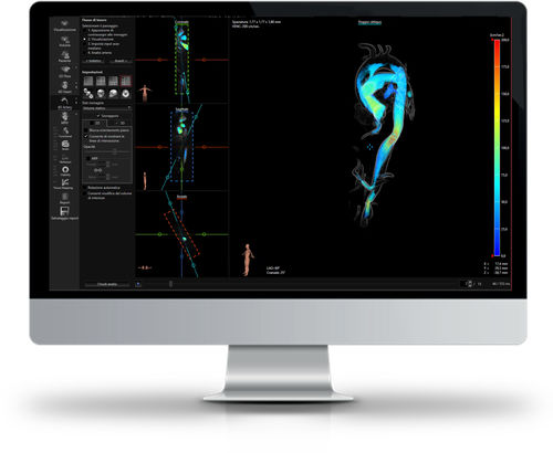 Software de análisis - CAAS MR - Esaote - para IRM / médico