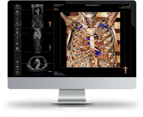 Software de visualización 3D - 3MENSIO - Esaote - de análisis / médico / TDM