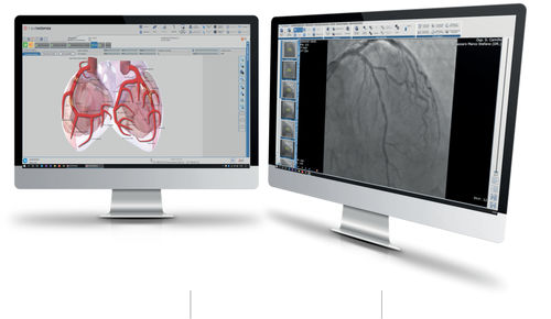 software para cardiología - Esaote