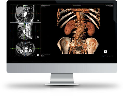 Software de visualización - SUITESTENSA RIS PACS - Esaote - de diagnóstico / para imágenes médicas / médico