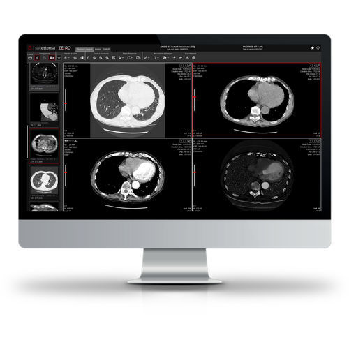 software para imágenes médicas - Esaote