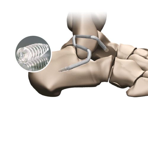 Prótesis de ligamento tendón grácil - 267 596 - FH Orthopedics - sintética