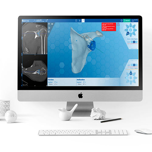 Software para cirugía de hombro - e-Ortho - FH Orthopedics - de visualización 3D / de revisión de prótesis / de anatomía