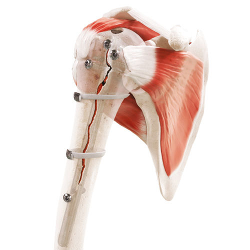 Alambre de cerclaje ortopédico para fractura periprotésica - Strapflex - FH Orthopedics - polímero multifilamento