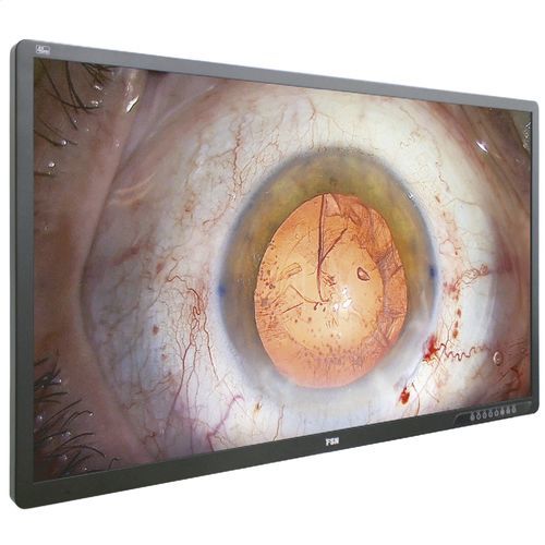 Monitor médico - FM-A5505DGC - FSN Medical Technologies - para endoscopia / quirúrgico / Full HD
