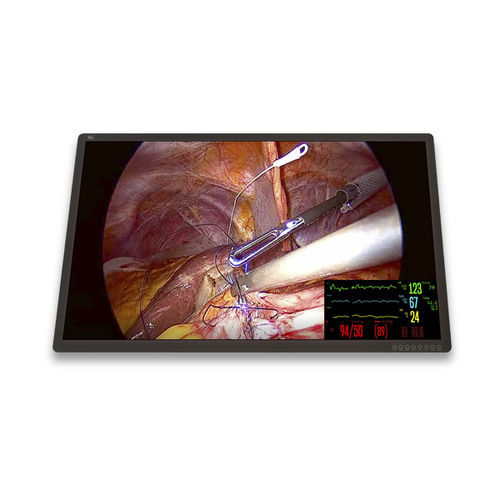 Monitor médico - FM-C5501DV - FSN Medical Technologies - quirúrgico / 3.840x 2.160 / 55"