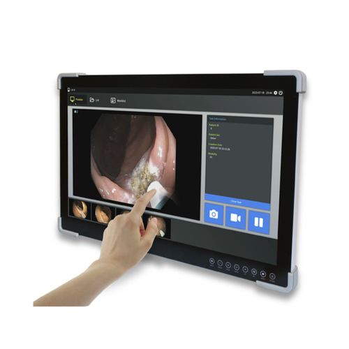 Monitor para endoscopia - FS-A2702D series - FSN Medical Technologies - para imágenes médicas / quirúrgico / para ecografía