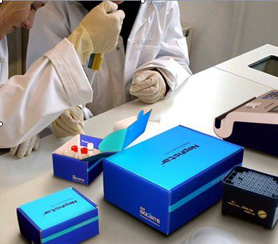 Reactivo multifunción - Nephstar  - Goldsite Diagnostics Inc. - de proteínas / IgA / de IgG