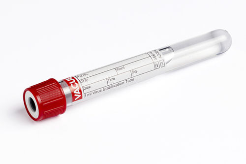 Tubo de extracción de laboratorio - 456161 - Greiner Bio-One  - cilíndrico / nasofaríngeo / fluido oral
