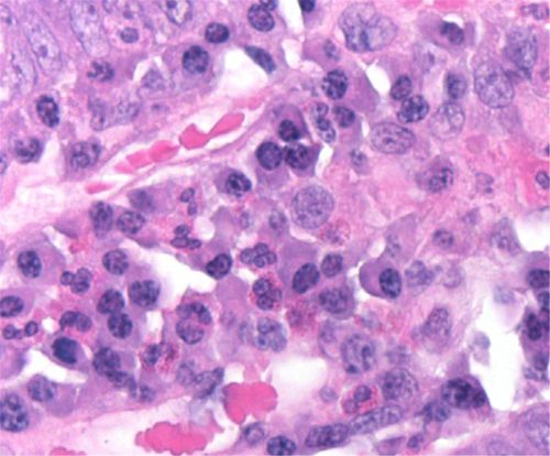 Reactivo colorante - 01HEMH1000 - Histo-Line Laboratories - para histologia