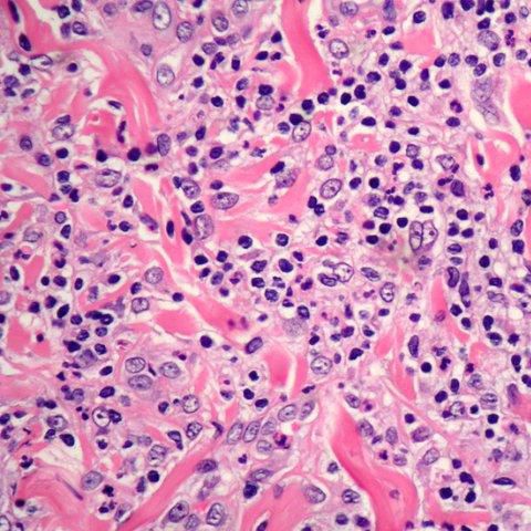 Reactivo colorante - Eosin Y 1% alcoholic solutions - Histo-Line Laboratories - para histologia / líquido