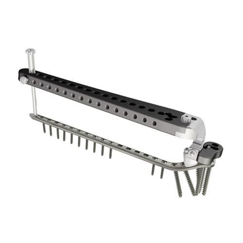 Placa de compresión para tibia - PTL - I.T.S.   - porción proximal / lateral / bloqueada