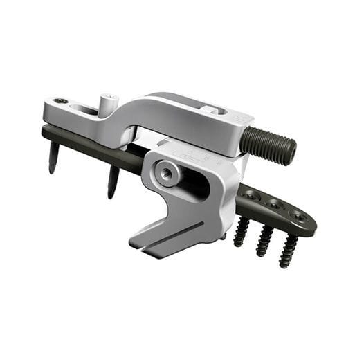 Placa de osteotomía para cúbito - UOL 2 - I.T.S.   - porción distal / bloqueada / metálica