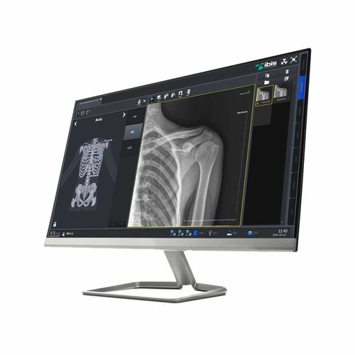 Software de radiografía - IBIS X Ray Systems - visualizador / para tablet PC