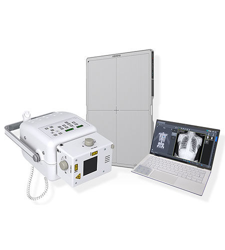 Sistema de radiografía digital - Home Ray - IBIS X Ray Systems - para radiografía polivalente / sin mesa / portátil