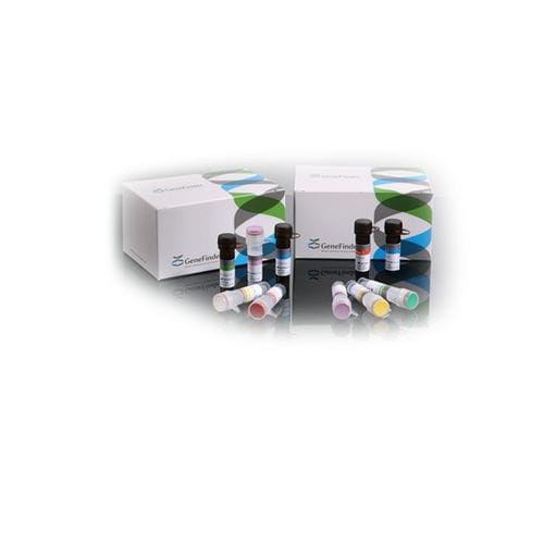 Kit de prueba del dengue - GeneFinder™ - OSANG Healthcare - de chikungunya / para enfermermedades infecciosas / de suero