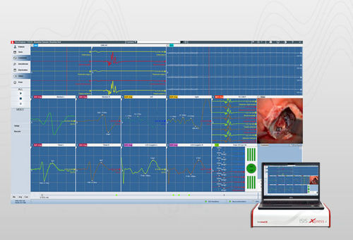 Software de hospital - NEX2019 - inomed Medizintechnik - para EMG / para cirugía / neurológico
