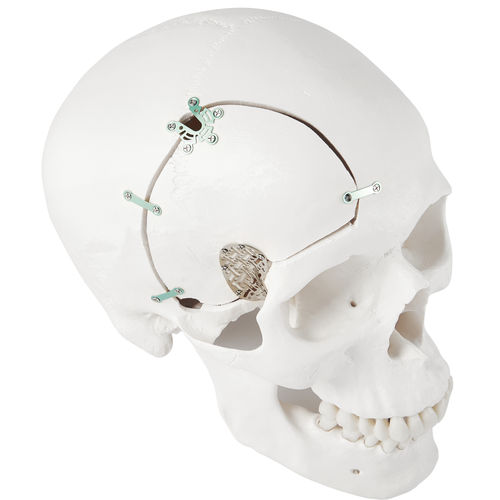 Sistema de fijación craneal no reabsorbible - LeForte Neuro 0.3 - Jeil Medical Corporation