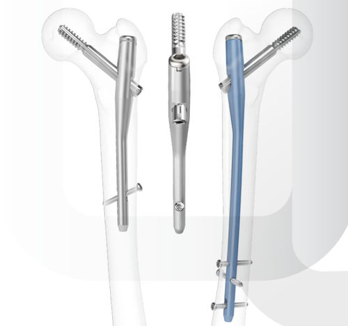 Clavo intramedular para fémur - ARIX - Jeil Medical Corporation - fijación proximal / fijación diafisaria / derecho