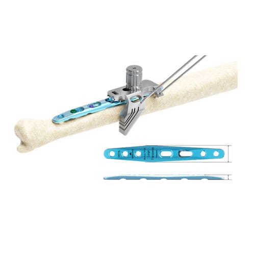 Placa de osteotomía para cúbito - ARIX 2.8 - Jeil Medical Corporation - porción medial / bloqueada / de titanio