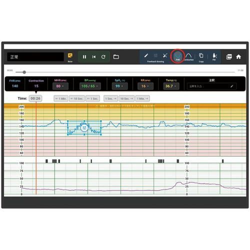 Simulador para monitor fetal - KKG-5 - Kyoto Kagaku  - atención materno-neonatal / de cardiotocografía / de monitorización