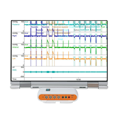Monitor de paciente portátil - Solar™ Go  - Laborie Medical Technologies - de manometría / para cuidados intensivos / para adulto
