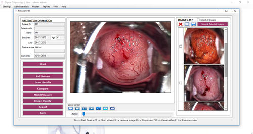 Sistema de gestión y análisis de datos de pacientes - 01047 series - Medgyn Products - de visualización / de análisis / para informes