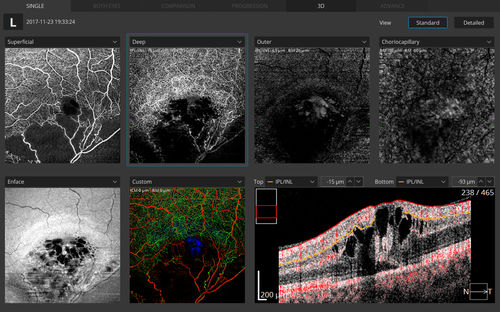 Módulo de software de angiografía - Optopol Technology - para oftalmología / de medición / de visualización