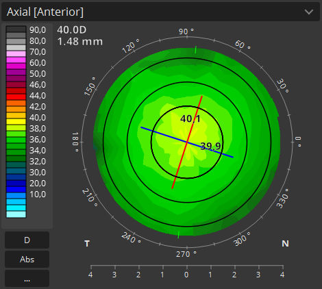 Módulo de software para oftalmología - T-OCT™ - Optopol Technology - de análisis / de captura / de córnea
