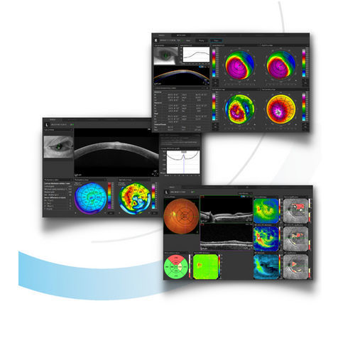 Software para oftalmología - SOCT 11.5 - Optopol Technology - de análisis / de captura / de oculometría