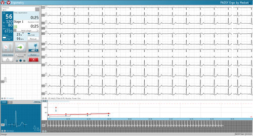 Software de análisis - PADSY Ergo - Medset Medizintechnik  - de medición / para equipo de prueba de esfuerzo cardiorrespiratorio