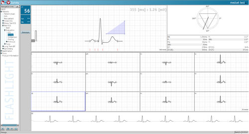 Software de análisis - Medset Medizintechnik  - de medición / para ECG