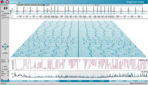 Software de análisis - Medset Medizintechnik  - de monitorización / para Holter cardíaco