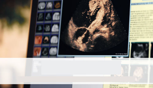 Software para informes - SonoWin&reg; - MESO - de hospital / para consulta médica / para historias clínicas