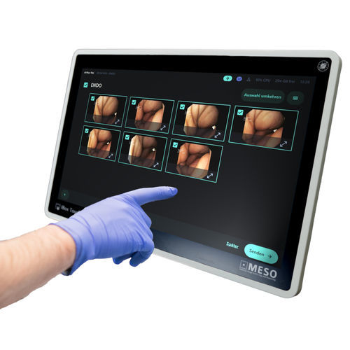 Grabadora de vídeo con DICOM - IBox Touch - MESO - médica / para endoscopia / HD