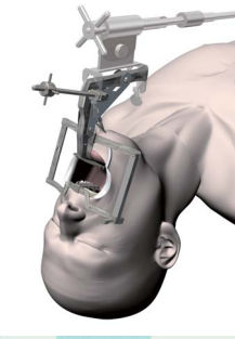 Faringoscopio para adulto - Satou - Nagashima Medical Instruments - de ángulo recto