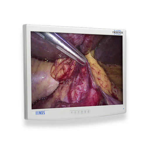Monitor médico - EndoVue®  - NDS Surgical Imaging - para imágenes médicas / para endoscopia / quirúrgico