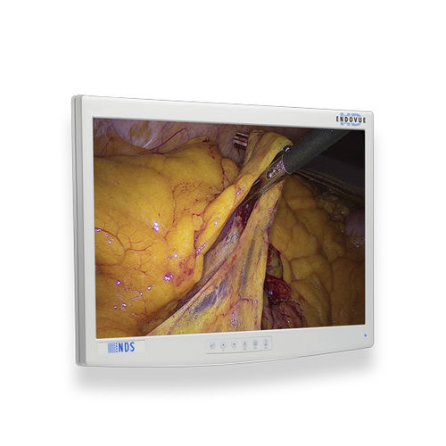 Monitor médico - EndoVue®  - NDS Surgical Imaging - para imágenes médicas / para endoscopia / quirúrgico