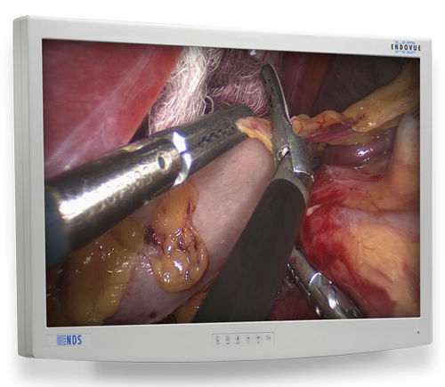 Monitor médico - EndoVue®  - NDS Surgical Imaging - para imágenes médicas / para endoscopia / de alta definición