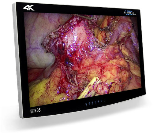 Monitor médico - RADIANCE® ULTRA - NDS Surgical Imaging - quirúrgico / 4K / 32"