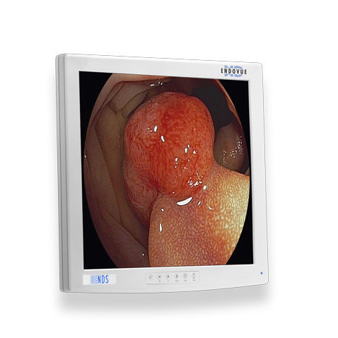Monitor médico - ENDOVUE® - NDS Surgical Imaging - para imágenes médicas / para endoscopia / de alta definición