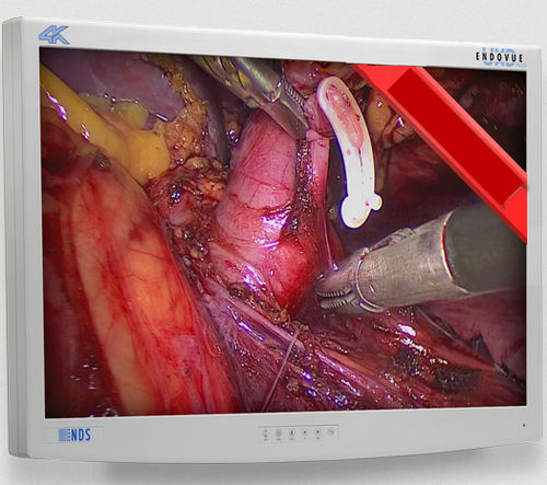Monitor médico - EndoVue Plus  - NDS Surgical Imaging - para endoscopia / de alta definición / 32"