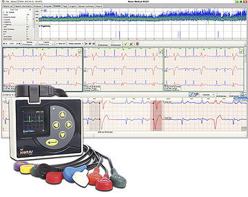 Software médico - NH-301 - NORAV Medical - para ECG / para historias clínicas / para Holter cardíaco