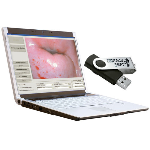 Software médico - DIGITALLY SOFT - OPTOMIC - de gestión de informes de pacientes / de control / para ginecología