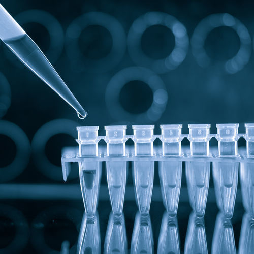 Kit de prueba de enfermedades de transmisión sexual - QP10706 - Randox Laboratories - de Trichomonas vaginalis / de Mycoplasma genitalium / de orina