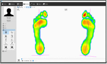 Software de análisis - v9 Essentials - Materialise - de medición / de intercambio / de creación de plantillas ortopédicas