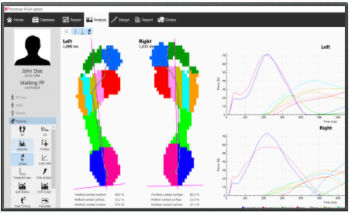 Software de análisis - v9 Clinical - Materialise - de medición / de intercambio / de creación de plantillas ortopédicas