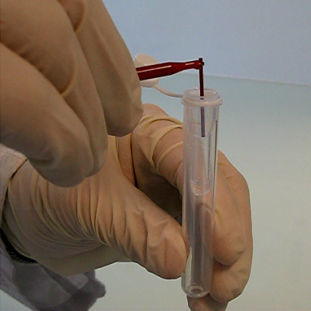 Kit de reactivos en solución - PN 2015 - Sebia  - de diagnóstico / de diabetes / de laboratorio