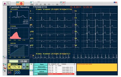 Módulo de software de gestión de datos - SEIVA Ergolog - Seiva - de registro / para electrocardiografía / para prueba de esfuerzo