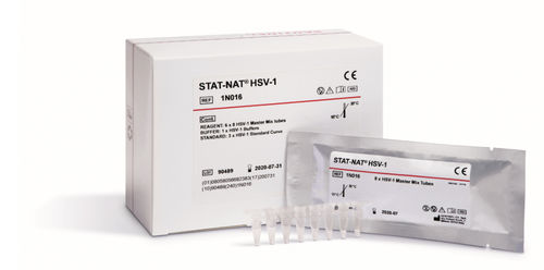 Kit de reactivos HSV - 1N016 - SENTINEL DIAGNOSTICS - enzima / plasma / de laboratorio